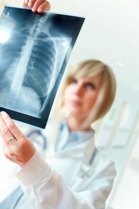 Image illustrative: un docteur examine attentivement une radio du thorax